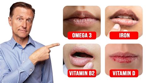 iron deficiency anemia lip discoloration